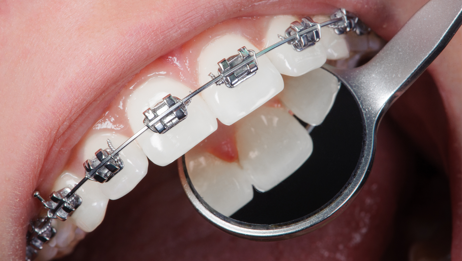 Image hover effect image