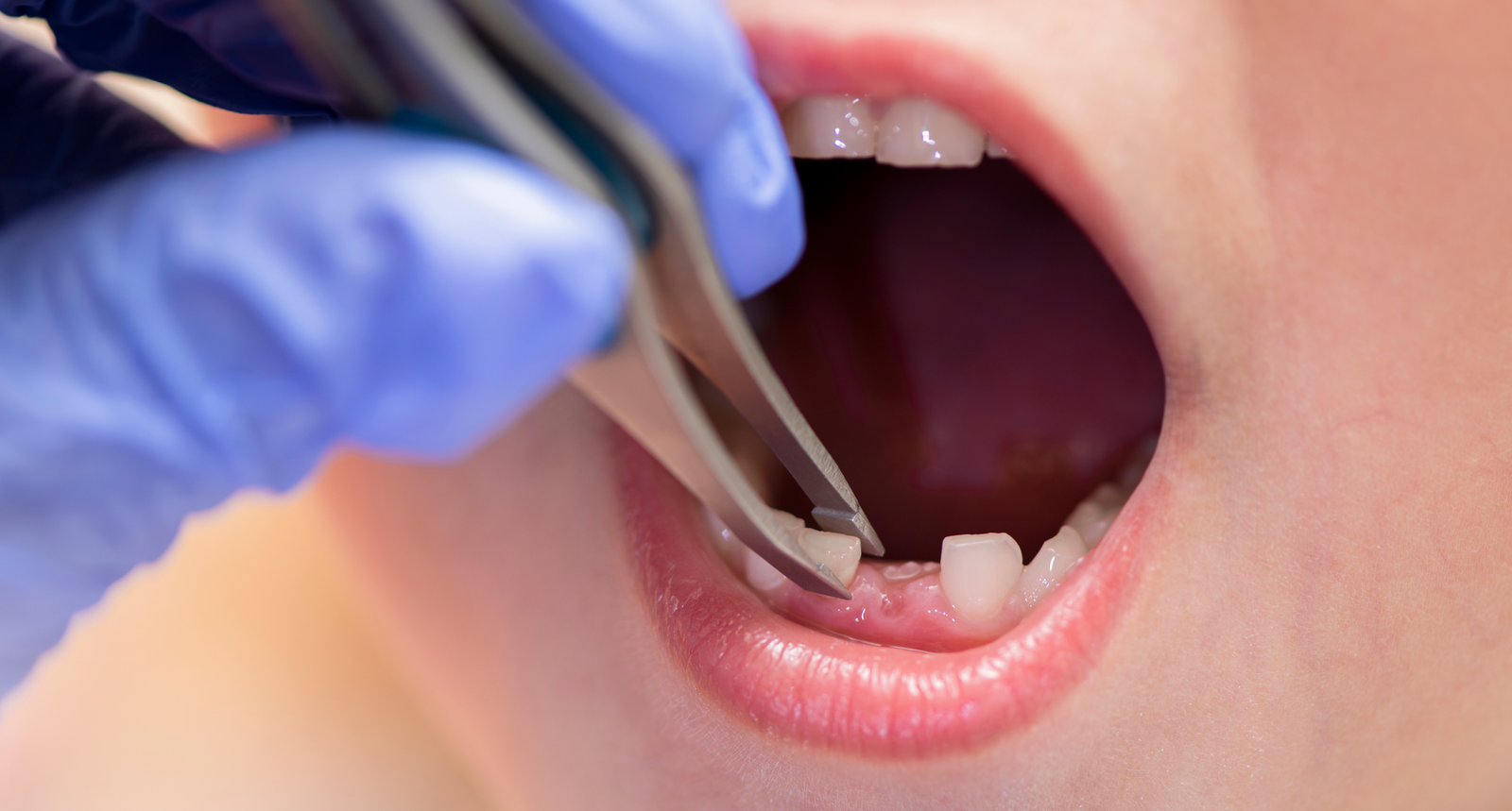 Image hover effect image