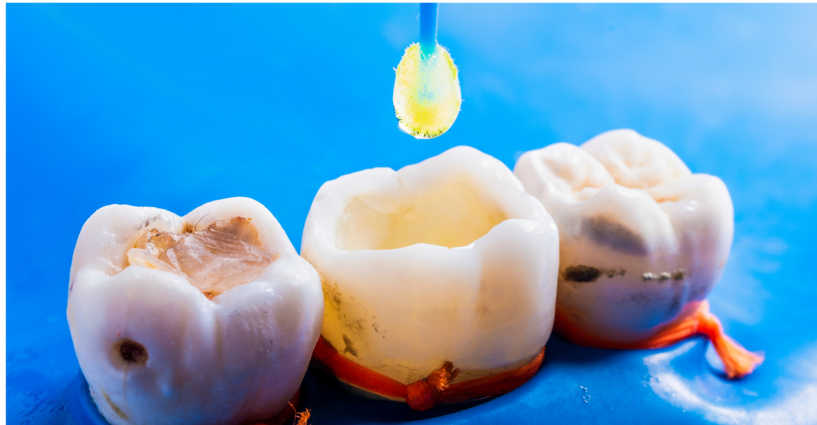 Image hover effect image