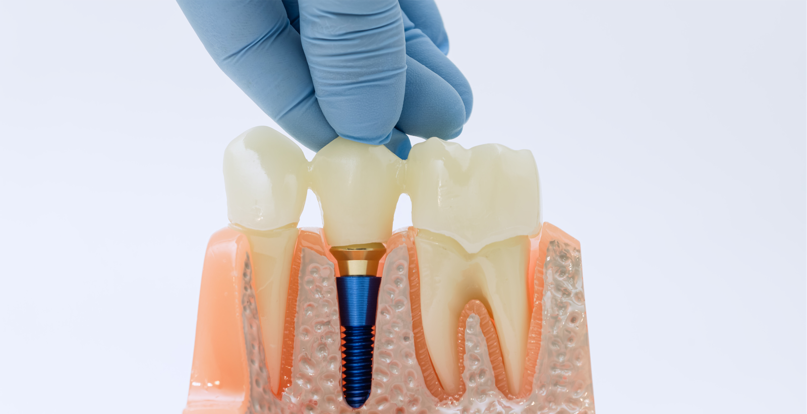 Image hover effect image