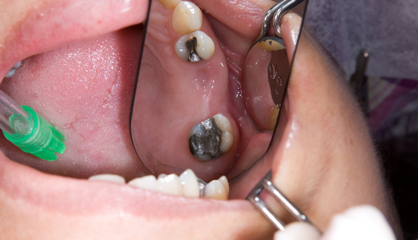 Image hover effect image