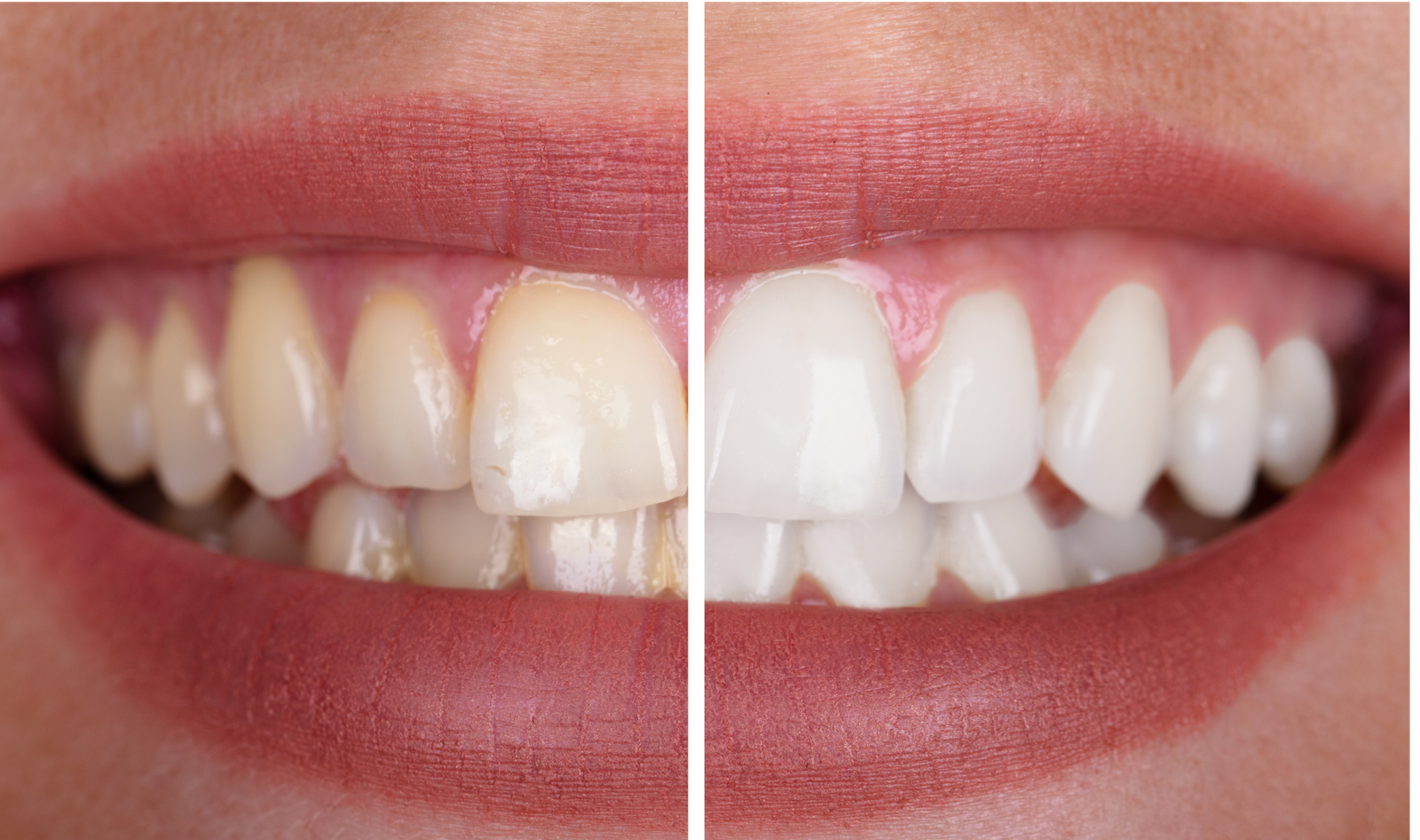 Image hover effect image